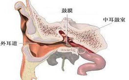 外耳道炎的症状